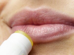 Aciklovir in herpes: učinkovita pomoč