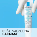 Koža, nagnjena k aknam