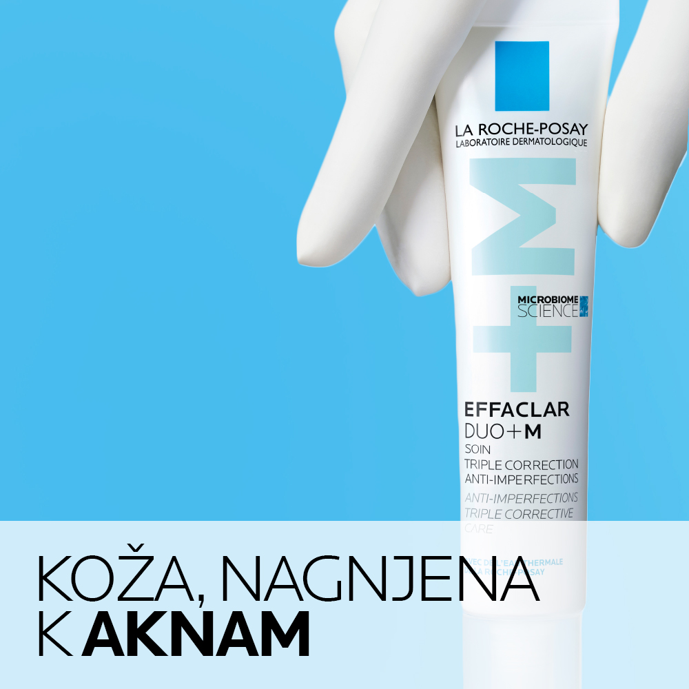 Koža, nagnjena k aknam
